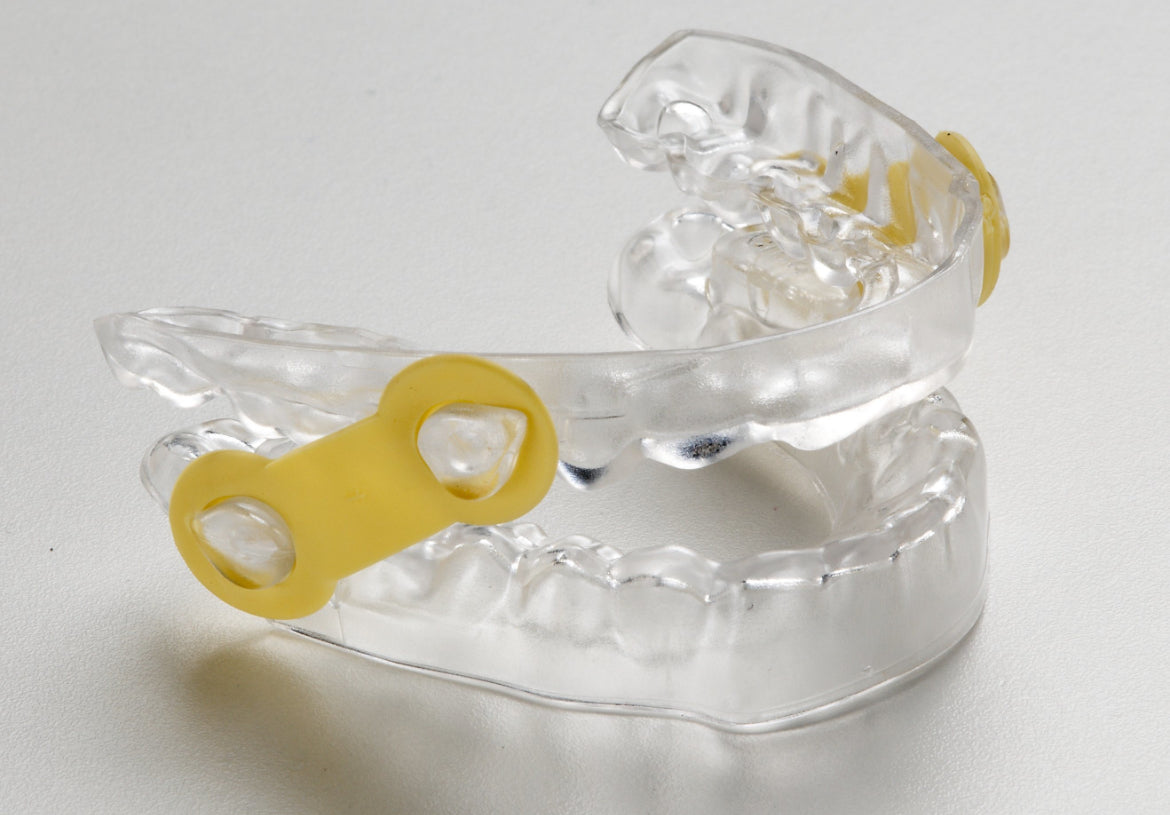 Advance the mandible and open bite to allow for less restricted airflow during sleep. 